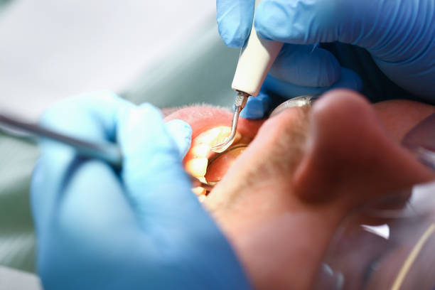 Best Broken or Chipped Tooth Repair in Louisa, KY