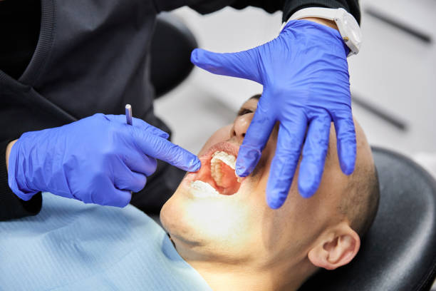 Best Knocked-Out Tooth (Avulsed Tooth) Treatment in Louisa, KY