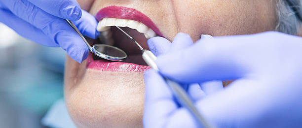 Best Emergency Dental Care for Sports Injuries in Louisa, KY