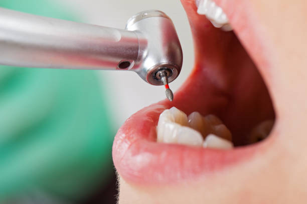 Best Walk-In Emergency Dental Services in Louisa, KY